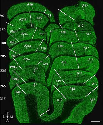 Characterization of Feedback Neurons in the High-Level Visual Cortical Areas That Project Directly to the Primary Visual Cortex in the Cat